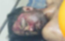 ছাতকে ব্রিজ থেকে পড়ে মটোরসাইকেল চালকের মৃত্যু