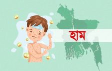 সিলেটে হাম উপসর্গে প্রাণ গেল আরেক শিশুর